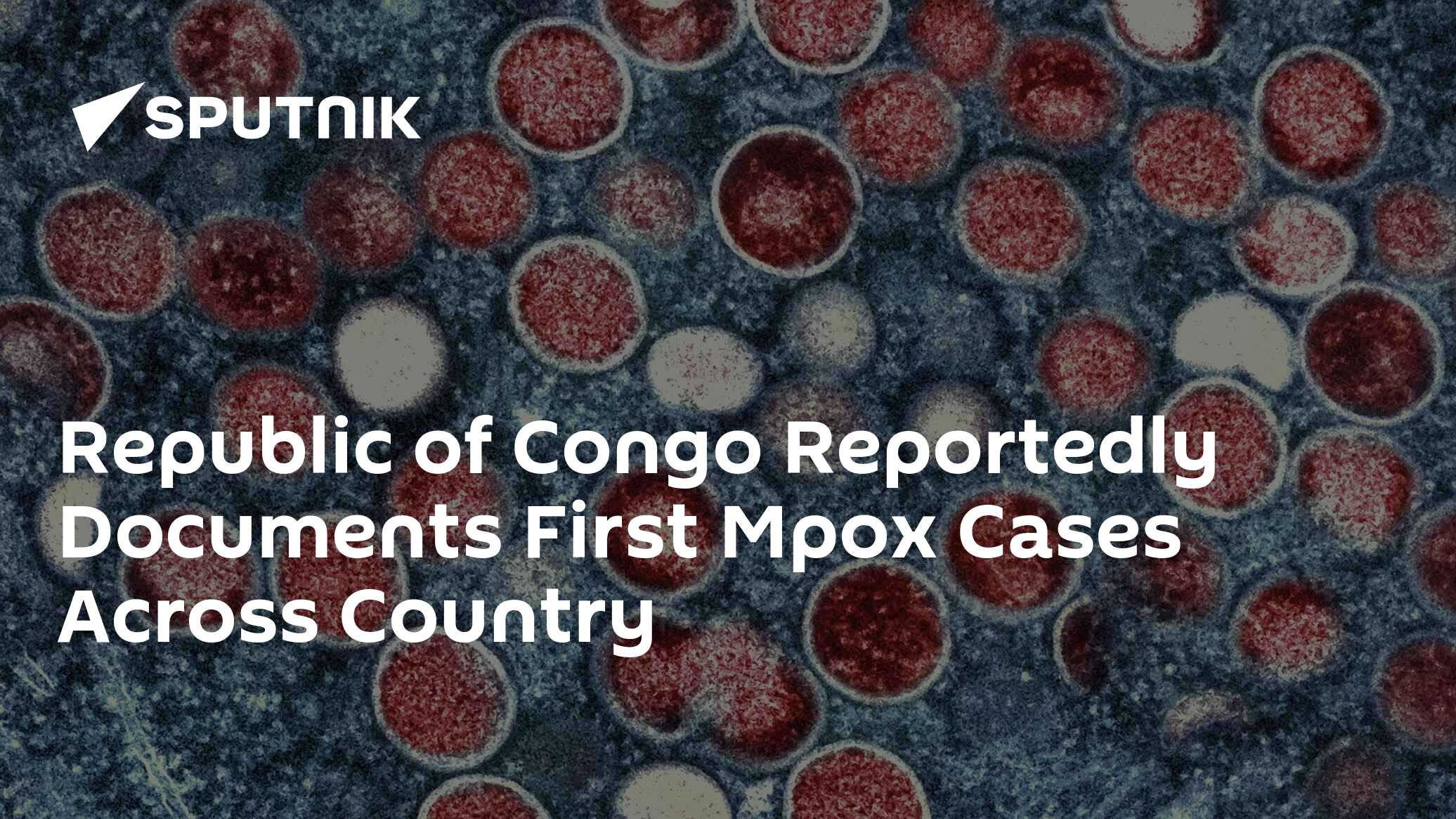 Republic of Congo Reportedly Documents First Mpox Cases Across Country