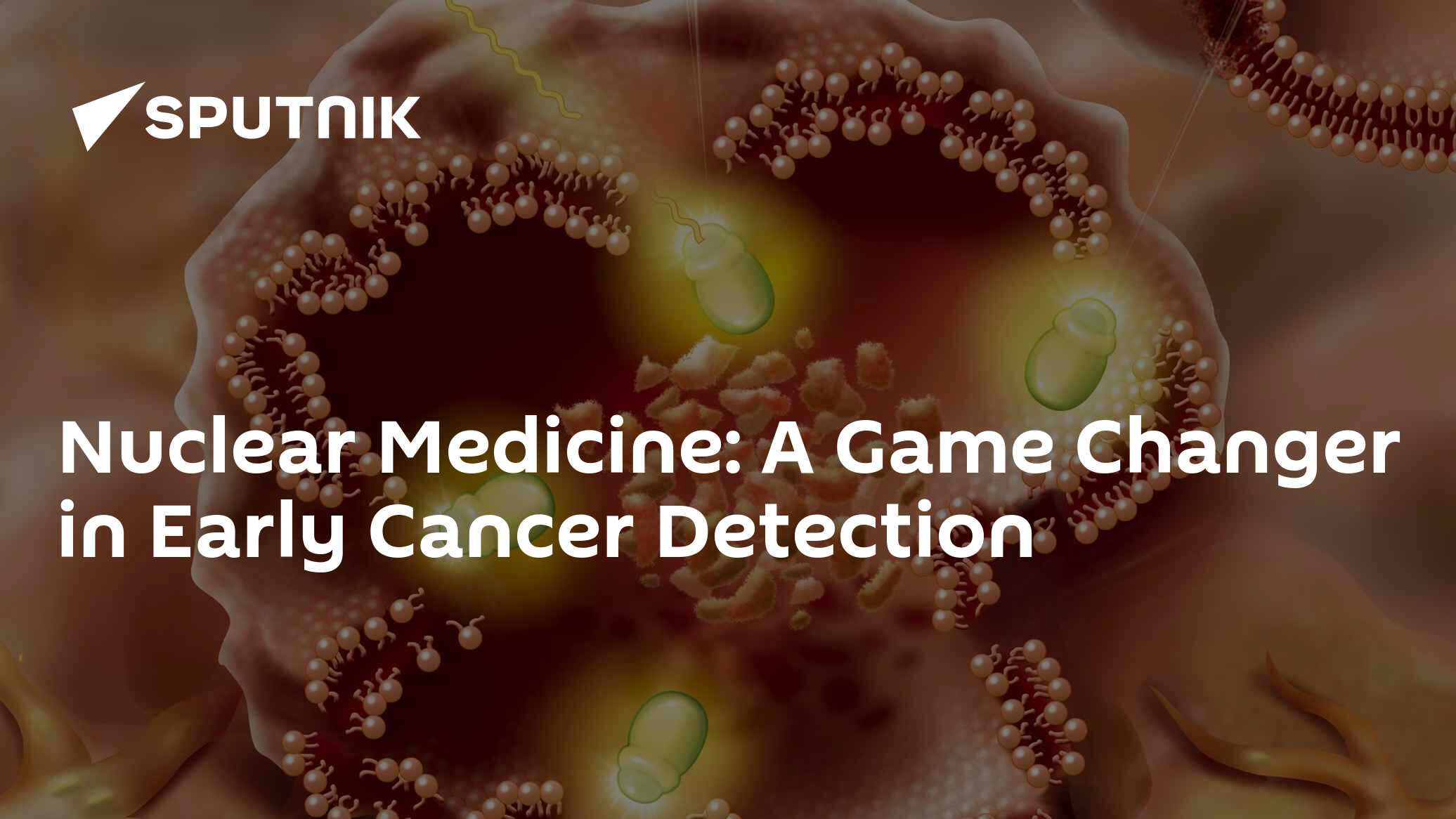 Nuclear Medicine: A Game Changer in Early Cancer Detection - 01.03.2025 ...