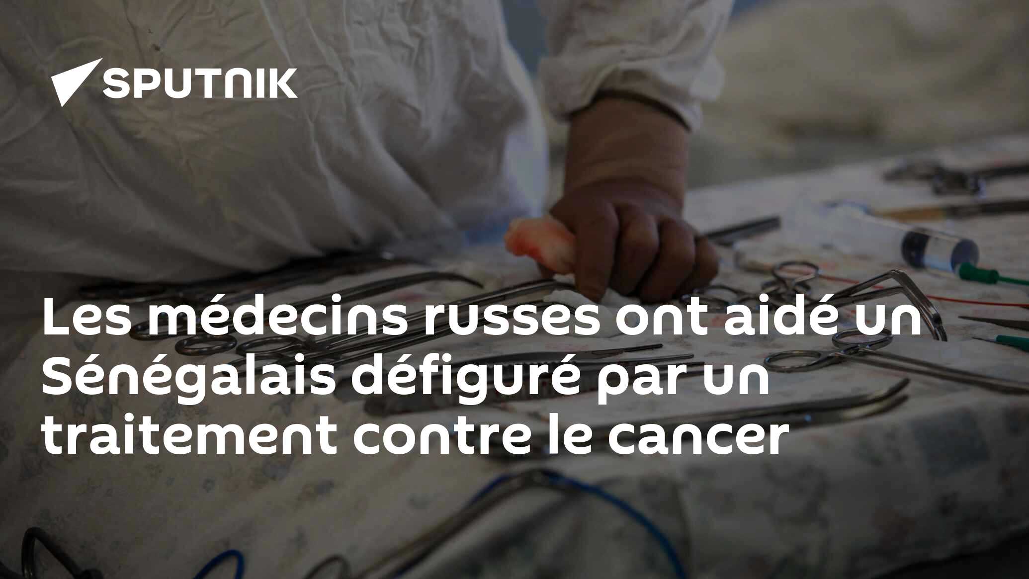 Les médecins russes ont aidé un Sénégalais défiguré par un traitement contre le cancer