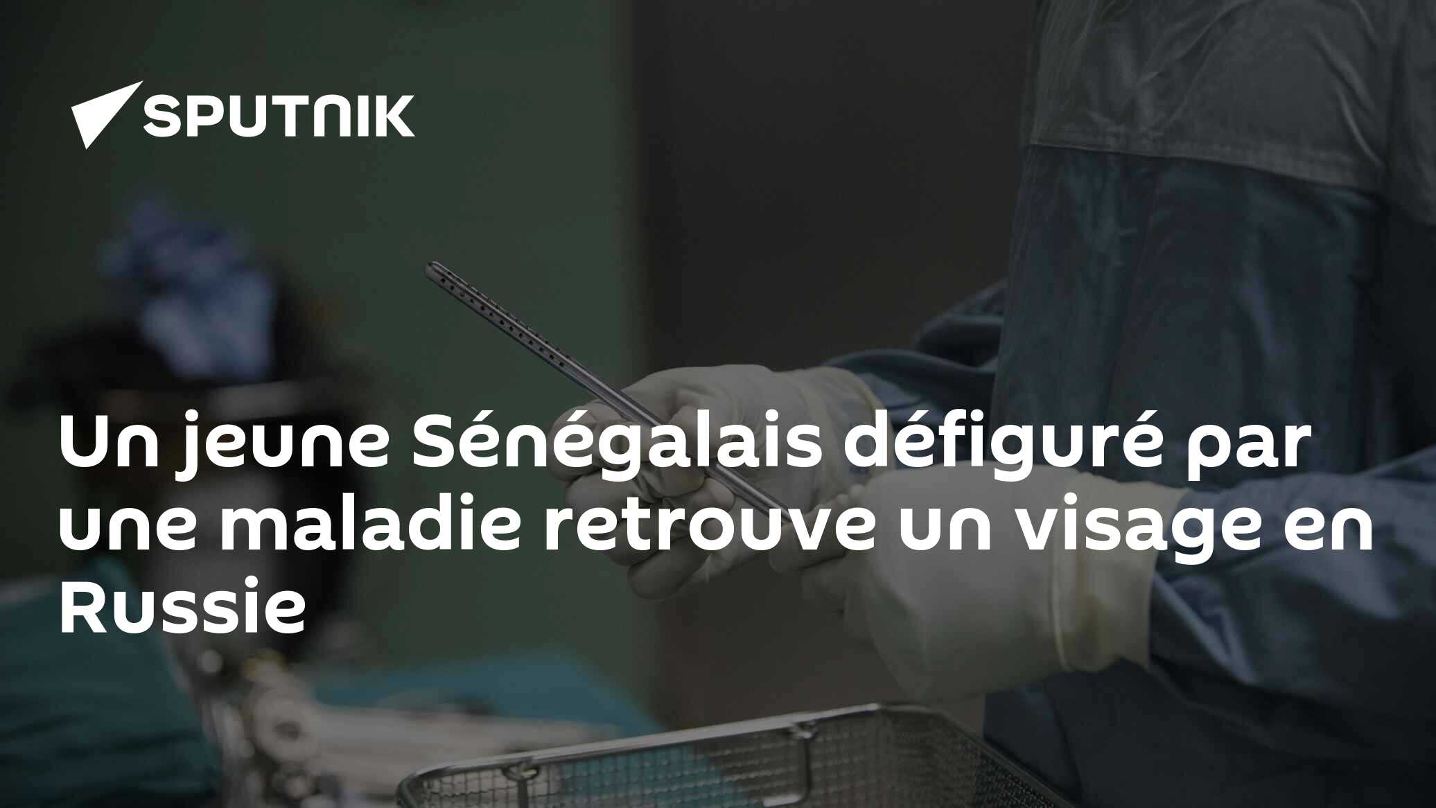 Un jeune Sénégalais défiguré par une maladie retrouve un visage en Russie