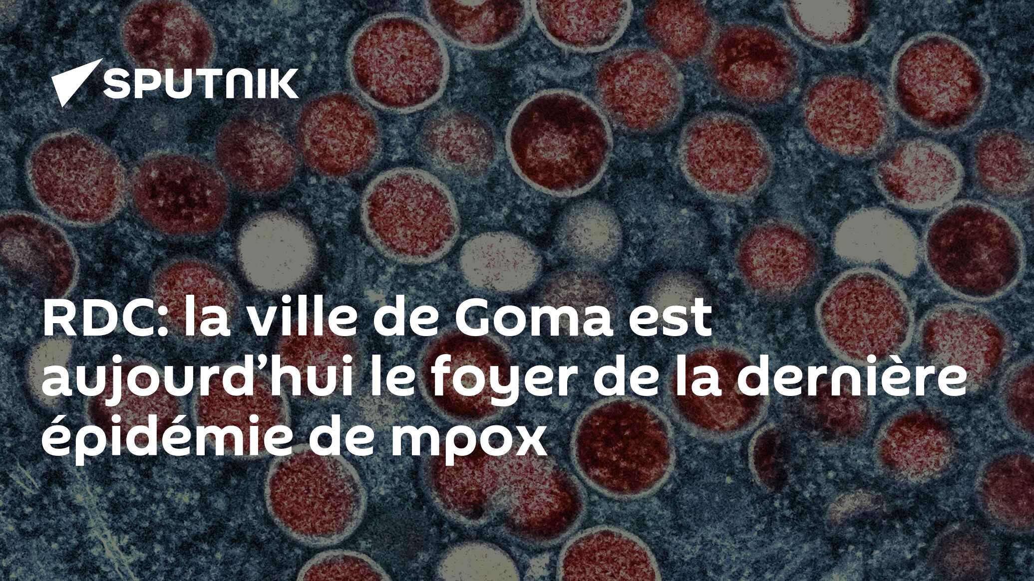 RDC: la ville de Goma est aujourd’hui le foyer de la dernière épidémie de mpox