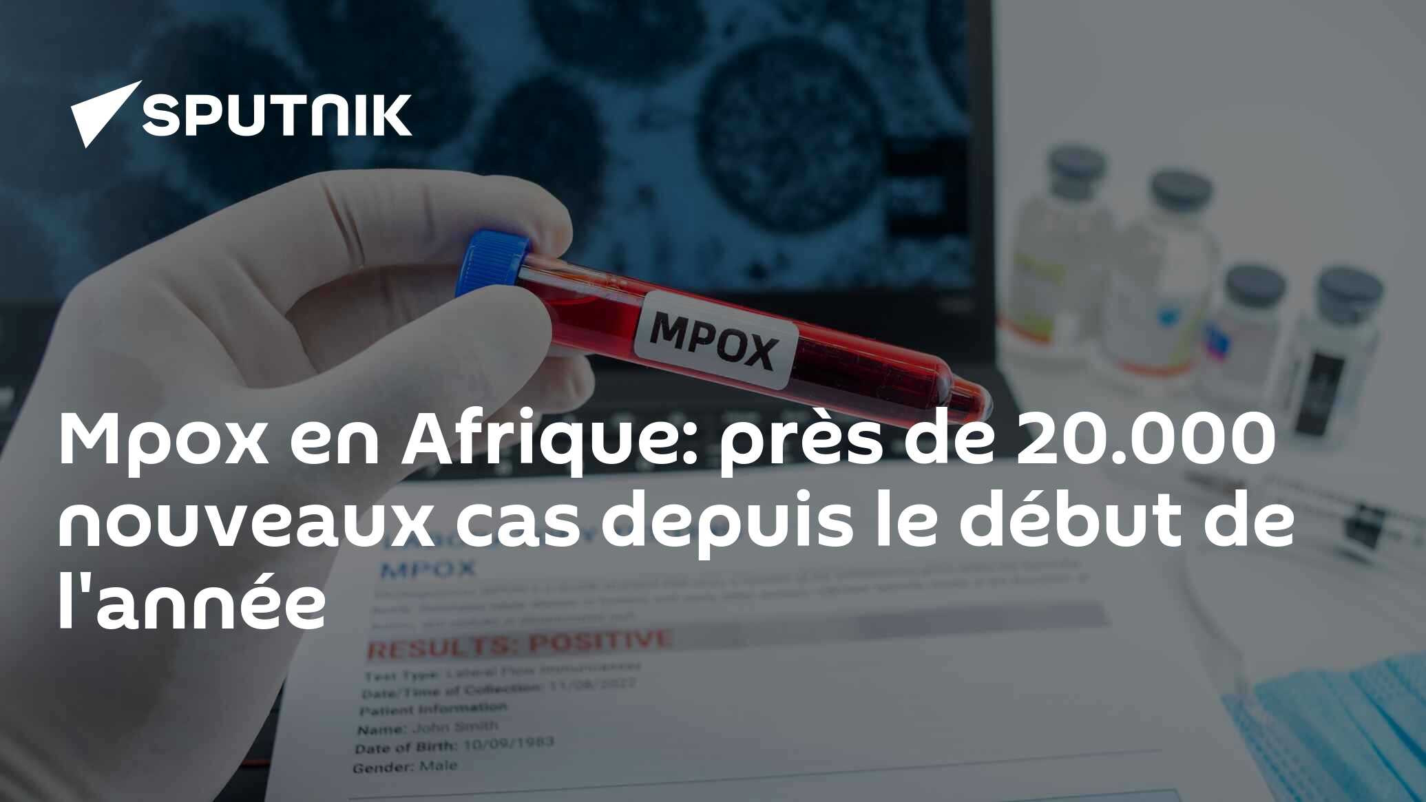 Mpox en Afrique: près de 20.000 nouveaux cas depuis le début de l'année