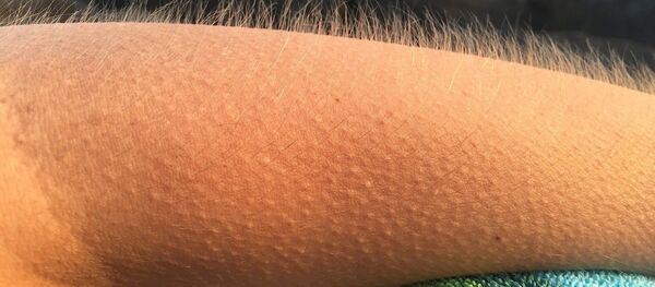 Chair de poule - Sputnik Afrique