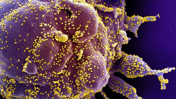 Une cellule infectée par des particules virales du SRAS-CoV-2 (en jaune) - photo d'archives - Sputnik Afrique