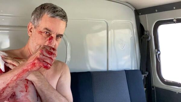 Le reporter vénézuelo-chilien Alejandro Kirk, blessé dans le Donbass - Sputnik Afrique