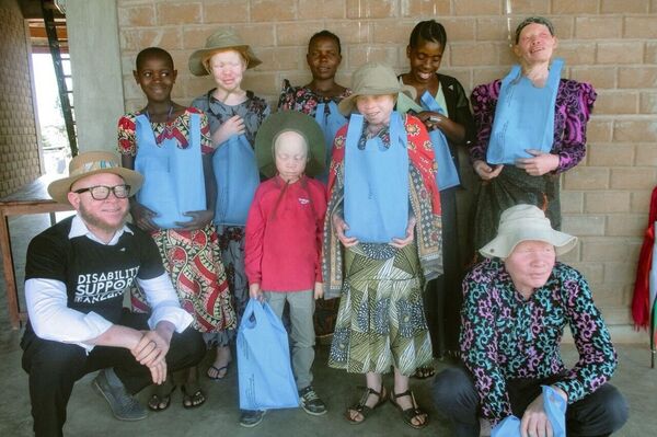 This photo was taken on January 1, 2022, in Ukerewe, where Sixmond Mdeka, a Tanzanian gospel reggae singer, preacher, and social advocate for disability and albinism awareness, organized a Christmas and New Year's party for marginalized groups, including people with albinism, the physically disabled, and the elderly, through his organization Disability Support Tanzania. - Sputnik Africa