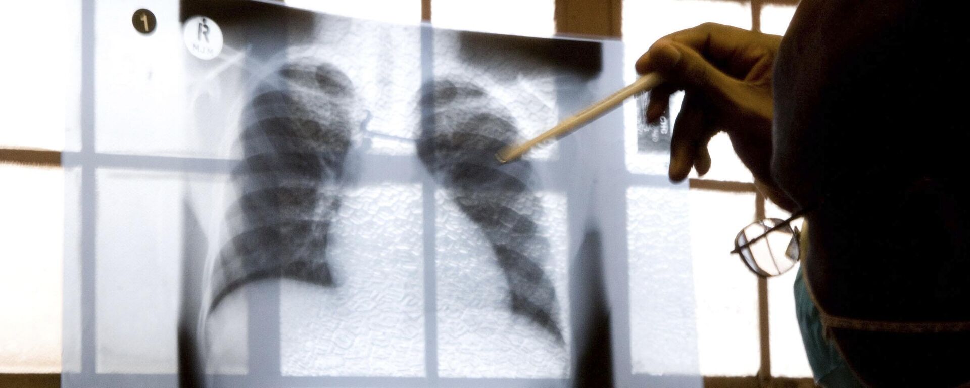 In this Friday, Nov. 9. 2007 file photo, a doctor examines chest X-rays at a tuberculosis clinic in Gugulethu, Cape Town, South Africa.  - Sputnik Africa, 1920, 02.09.2023