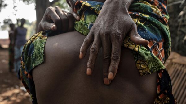 Sebaste Kondo, 57, shows the scar in his back, left by a bullet that remained lodged there since 2018, in the Central African Republic village of Cesacoba Sunday, Feb. 14, 2021. - Sputnik Africa