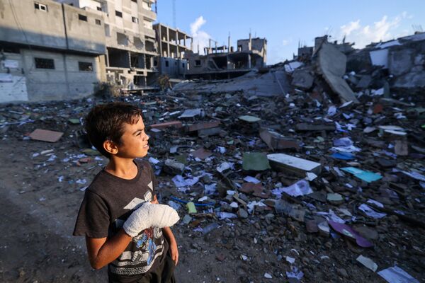 An injured Palestinian boy, 12-year-old Mohammed Sofi, looks at buildings destroyed during Israeli airstrikes near his home at the Rafah refugee camp in the southern Gaza Strip, on October 16, 2023.  - Sputnik Africa