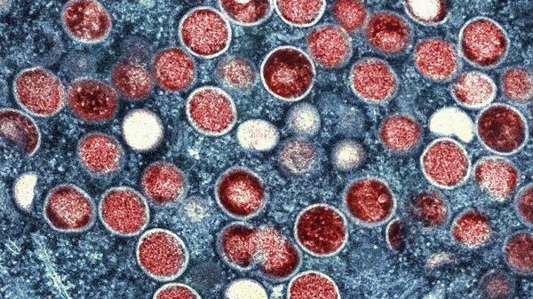 This colorized electron microscope image provided by the National Institute of Allergy and Infectious Diseases shows mpox particles, red, found within an infected cell, blue, cultured in a laboratory in Fort Detrick, Md. - Sputnik Africa