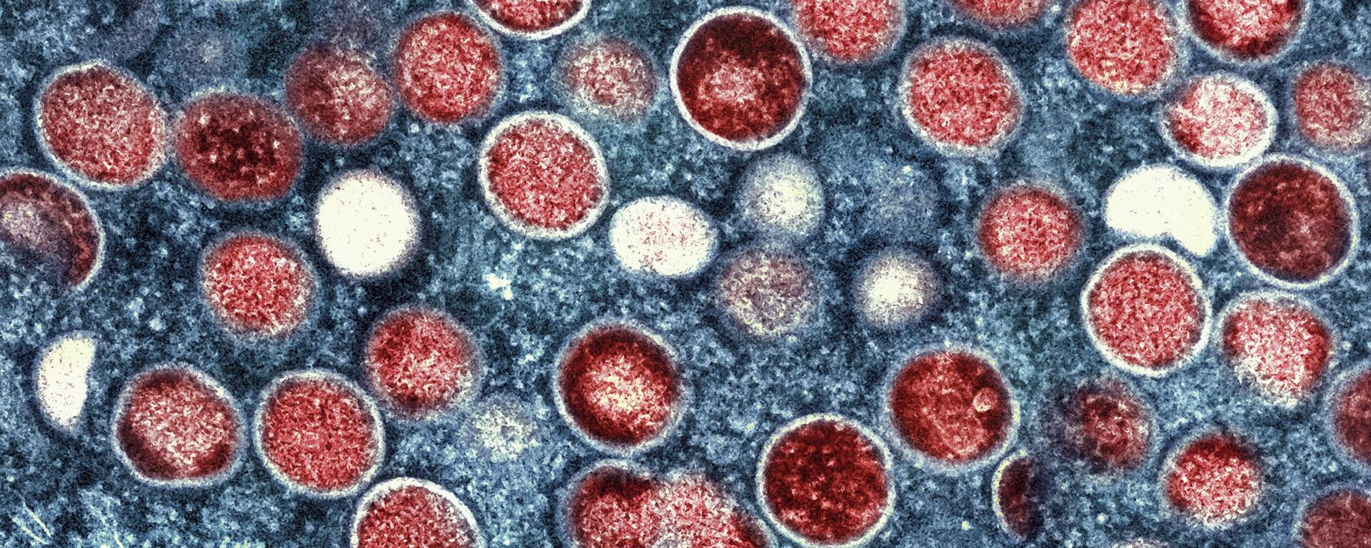 This colorized electron microscope image provided by the National Institute of Allergy and Infectious Diseases shows mpox particles, red, found within an infected cell, blue, cultured in a laboratory in Fort Detrick, Md. - Sputnik Africa, 1920, 15.10.2024