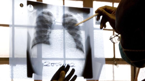 A doctor examines chest X-rays at a tuberculosis clinic in Gugulethu, Cape Town, South Africa on November 9, 2007. - Sputnik Africa