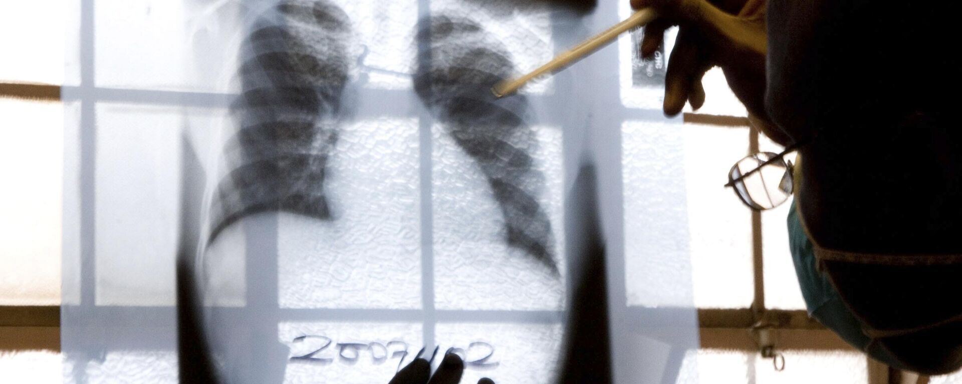 A doctor examines chest X-rays at a tuberculosis clinic in Gugulethu, Cape Town, South Africa on November 9, 2007. - Sputnik Africa, 1920, 31.03.2024