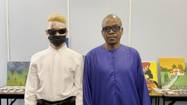 Khadim, Sénégalais pris en charge en Russie pour une reconstruction de visage - Sputnik Afrique