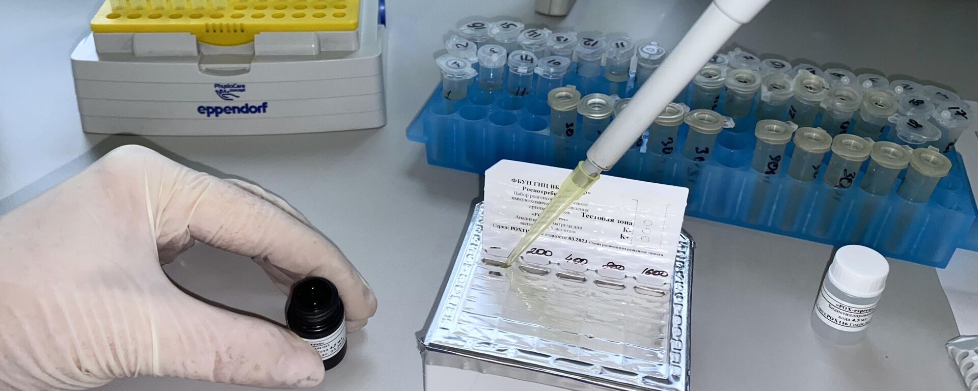 Mpox screening test - Sputnik Africa, 1920, 05.09.2024