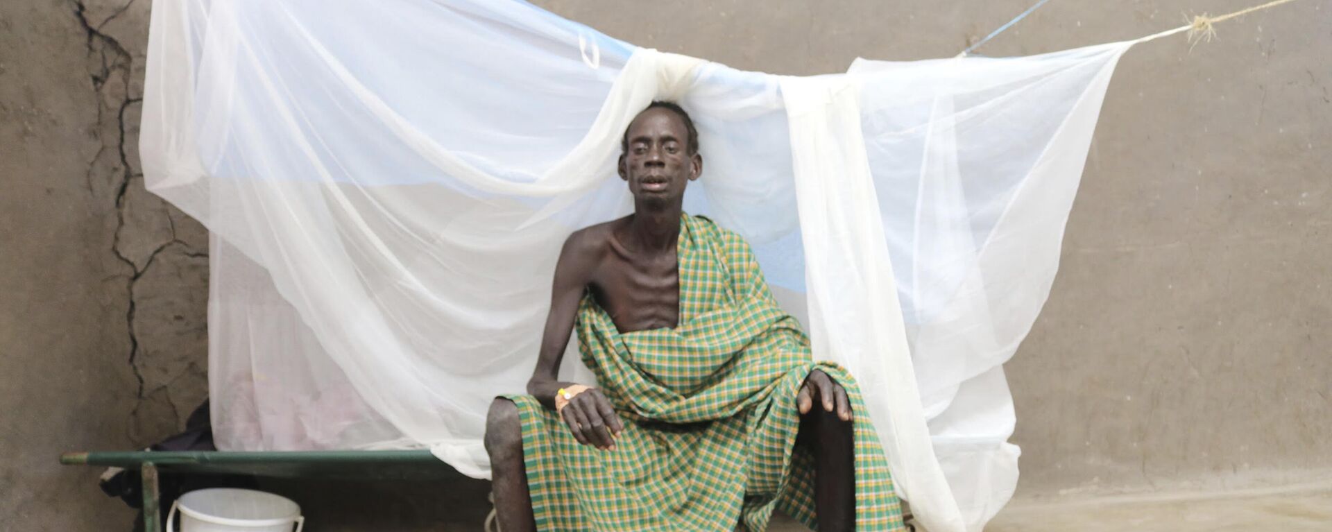 Machar Weituor sits on his bed  at a cholera clinic in Pieri South Sudan - Sputnik Africa, 1920, 23.08.2024