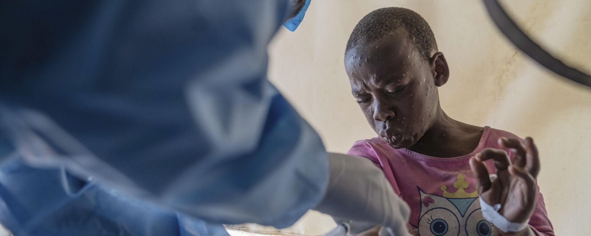 A health worker attends to an mpox patient, at a treatment center in Munigi, eastern Congo, Aug. 19, 2024. - Sputnik Africa, 1920, 01.11.2024