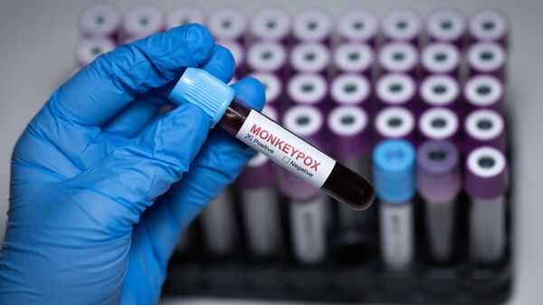 A Monkeypox (Mpox) blood test tube, which is marked positive, is seen among other blood test tubes in Ankara, Turkiye on August 28, 2024.  - Sputnik Africa