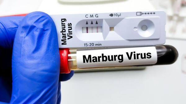 Doctor holding Rapid test cassette and blood sample for Marburg virus. medical conceptual image. - Sputnik Africa