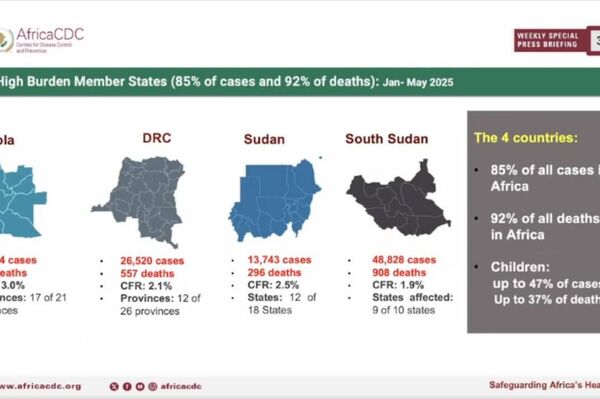 Africa Faces Surge in Mpox & Cholera: CDC Calls for Urgent Action - Sputnik Africa