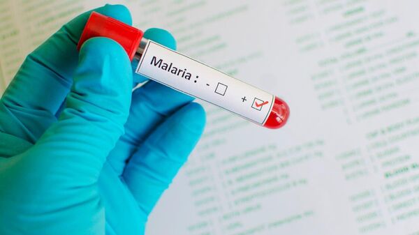 Russian Scientists Invent Country's First Rapid Malaria Test, Human Welfare Watchdog Says - Sputnik Africa