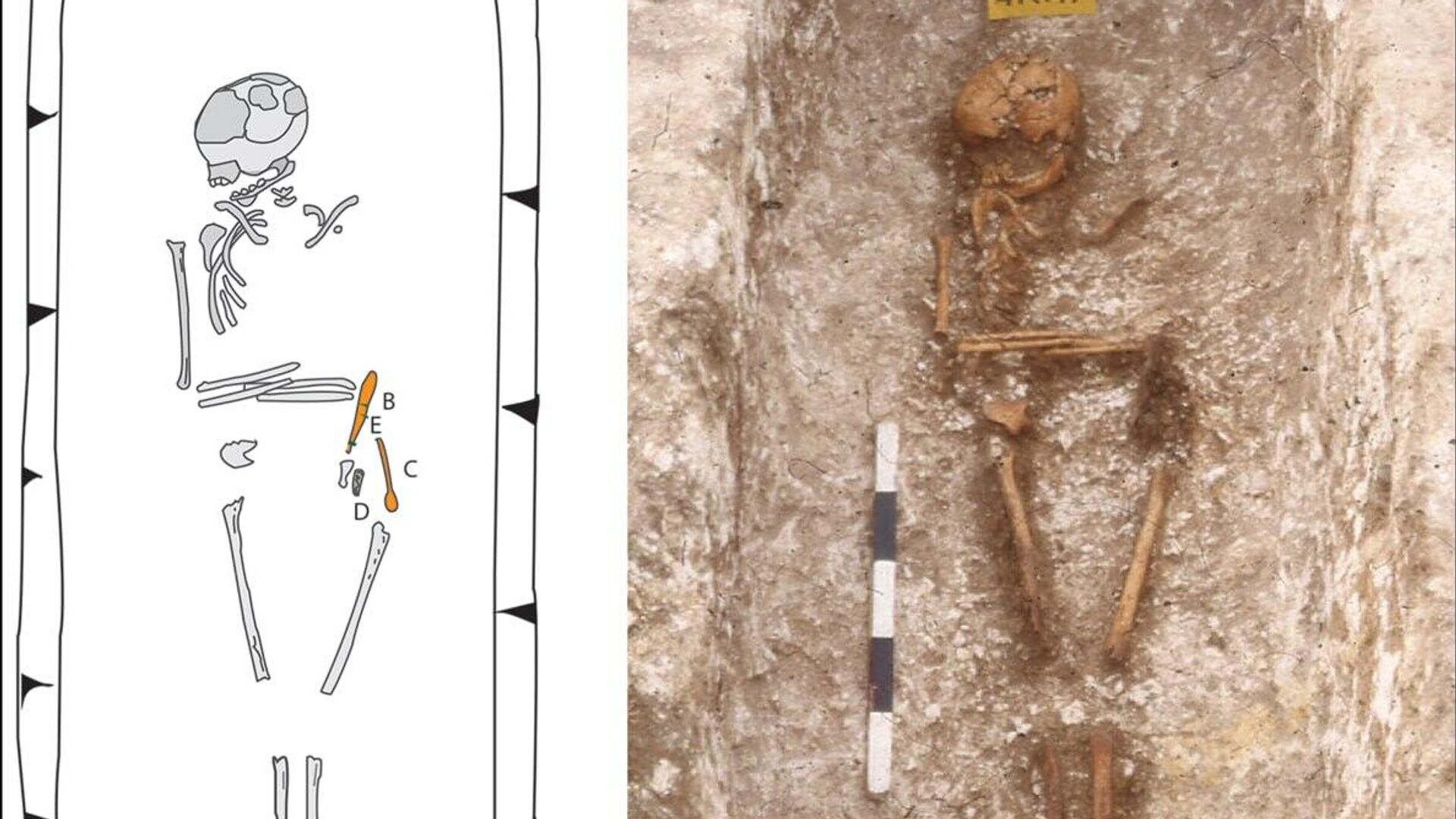 Angleterre médiévale: des squelettes révèlent une surprise africaine Angleterre médiévale: des squelettes révèlent une surprise africaine - Sputnik Afrique, 1920, 23.08.2025