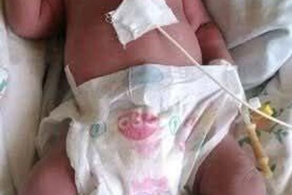 First in Africa and Second in the World: Ethiopia Achieves Historic Intrauterine Blood Transfusion Feat First in Africa and Second in the World: Ethiopia Achieves Historic Intrauterine Blood Transfusion Feat - Sputnik Africa