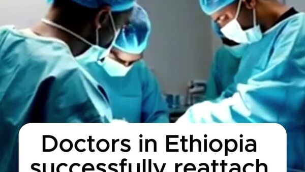 Ethiopia's Samaritan Surgical Center Announces First Successful Reattachment of a Machine-Severed Hand - Sputnik Africa