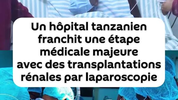 Un hôpital tanzanien entre dans l'histoire avec 4 transplantations rénales par laparoscopie - Sputnik Afrique