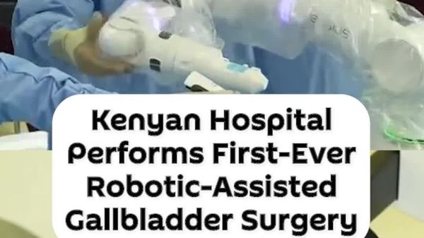 Nairobi Hospital Performs Kenya’s First Robotic Gallbladder Surgery - Sputnik Africa