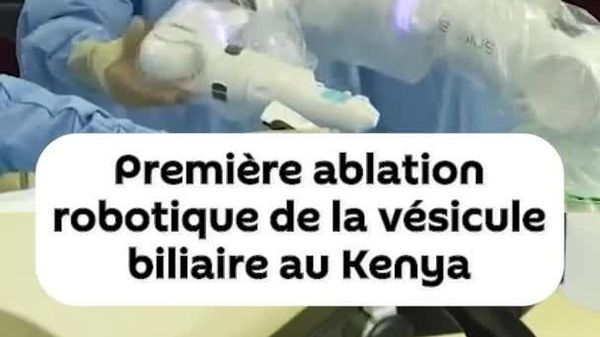 Première ablation robotique de la vésicule biliaire au Kenya - Sputnik Afrique