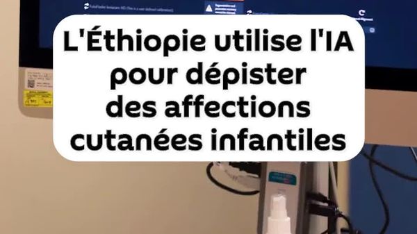 L'IA aide à dépister des maladies de peau infantiles en Éthiopie - Sputnik Afrique