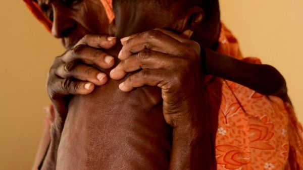 US Spending on Iran Conflict Could Fund Year of Fighting Hunger in Africa: Sputnik Analysis - Sputnik Africa