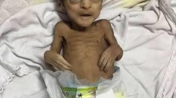 À Gaza, 158 - Sputnik Afrique