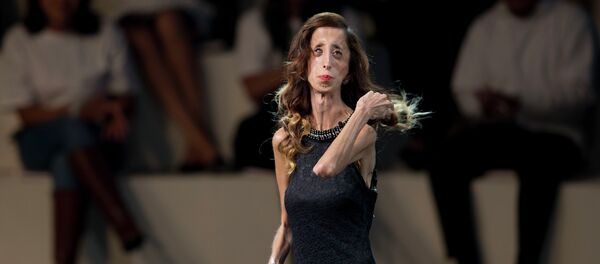 Lizzie Velasquez - Sputnik Afrique