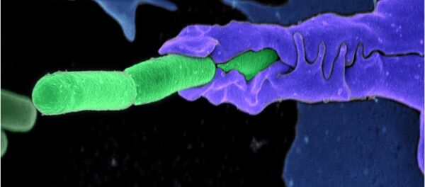 L'anthrax. L'anthrax. - Sputnik Afrique