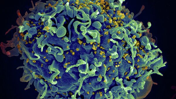Le virus VIH (en jaune) en train d'infecter une cellule humaine - Sputnik Afrique