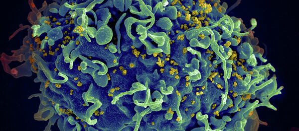 HIV, the AIDS virus (yellow), infecting a human cell HIV, the AIDS virus (yellow), infecting a human cell - Sputnik Afrique