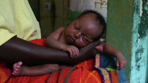 Severely malnourished child - Sputnik Afrique