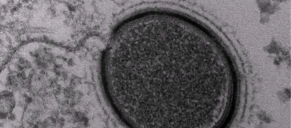 Virus géant - Sputnik Afrique