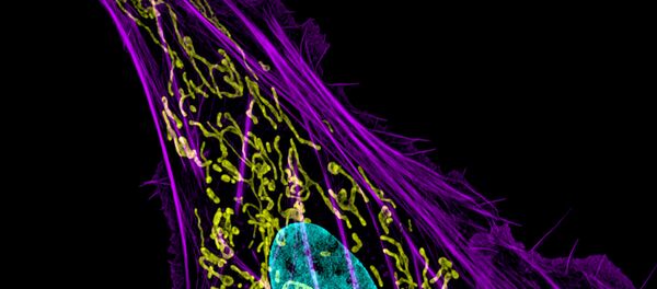 Cancer cell - Sputnik Afrique