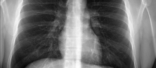 radio des poumons - Sputnik Afrique