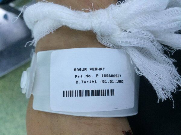 Un combattant de Daech soigné à l’hôpital Ersin Aslan Un combattant de Daech soigné à l’hôpital Ersin Aslan - Sputnik Afrique