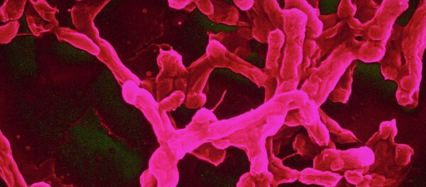 Une bactérie résistante à tous les antibiotiques découverte aux Etats-Unis - Sputnik Afrique