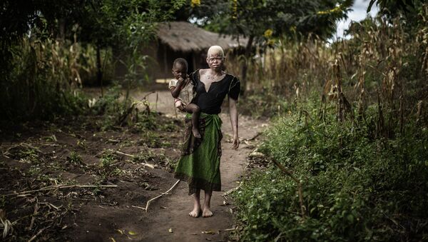 Albinos africains - Sputnik Afrique