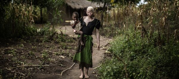 Les albinos africains Les albinos africains - Sputnik Afrique