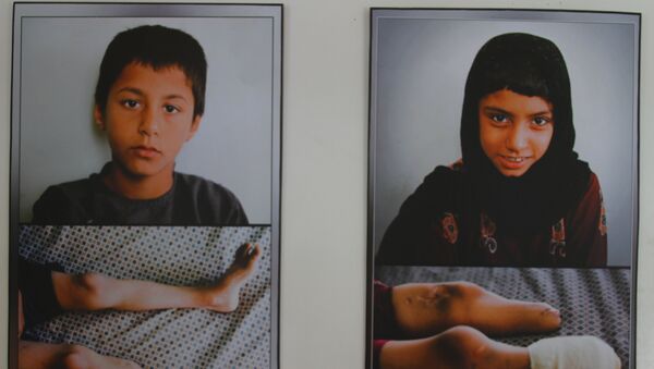 Scars of War: Images of Afghan Anatomy - Sputnik Afrique
