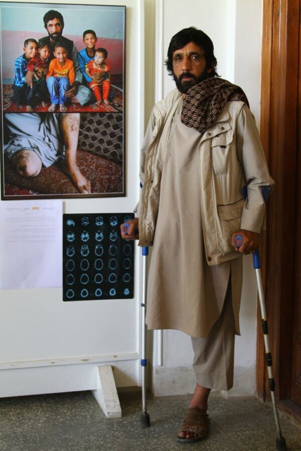 L'Anatomie de l'Afghanistan en images L'Anatomie de l'Afghanistan en images - Sputnik Afrique