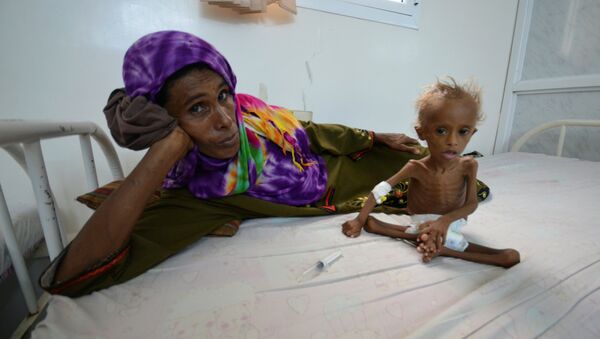 Les enfants, premières victimes du conflit au Yémen - Sputnik Afrique