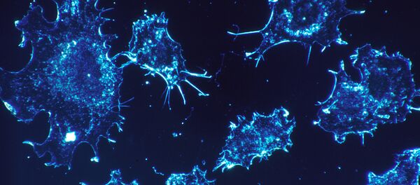 Cellules cancéreuses - Sputnik Afrique